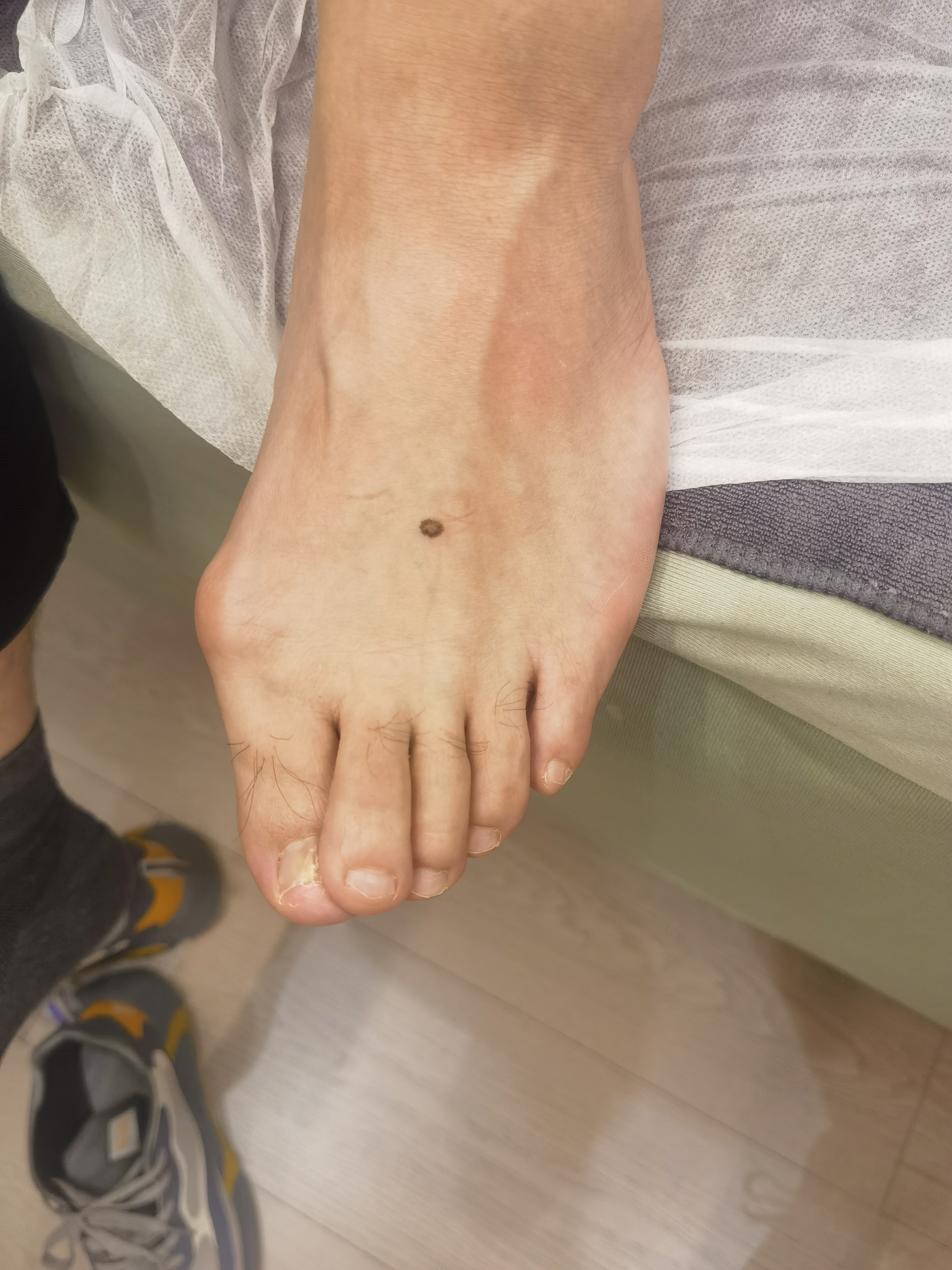 鼻炎贴的位置-吾爱推拿